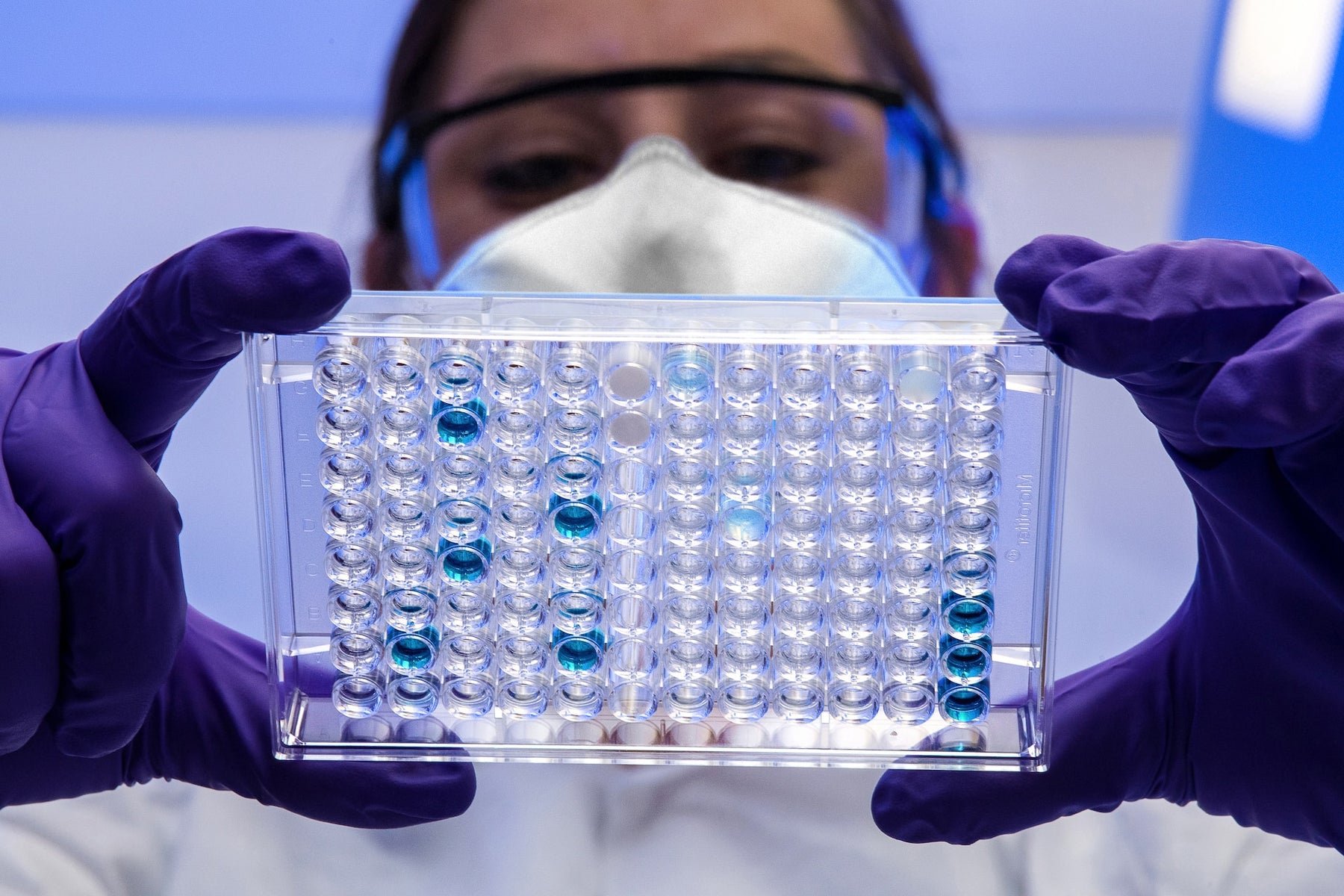Step-by-Step Guide to Performing a PCR Blank Check ๐งช