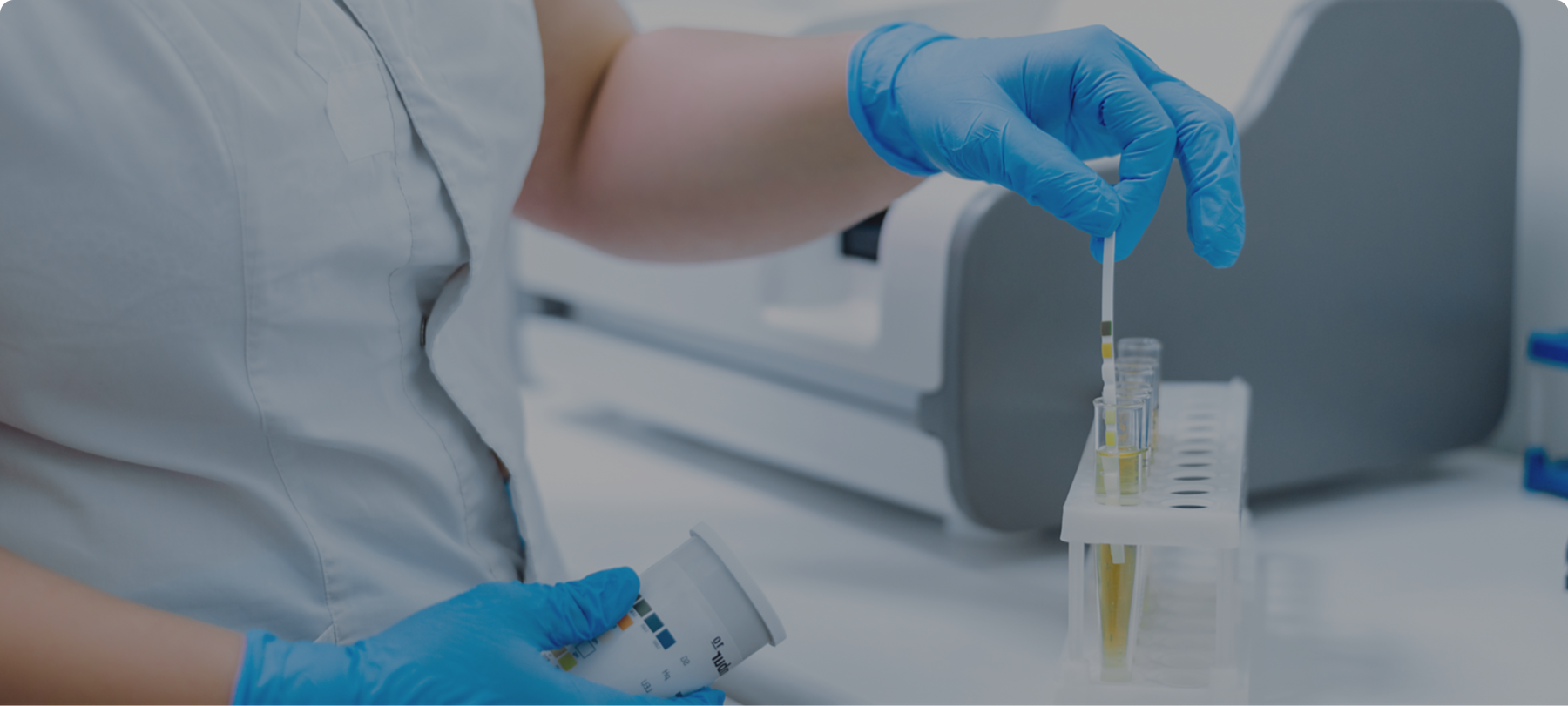 How to Test Urine for UTIs using PCR