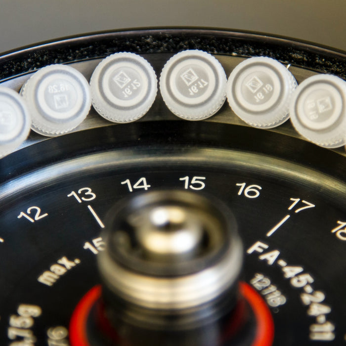 Running Controls and Samples on Your Yumizen H2500: A Step-by-Step Guide