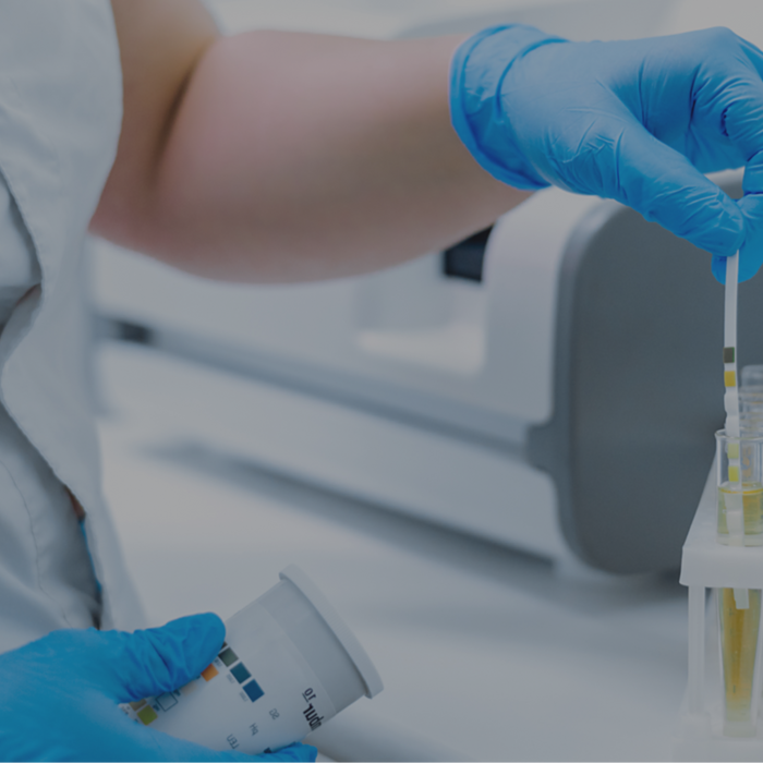 How to Test Urine for UTIs using PCR